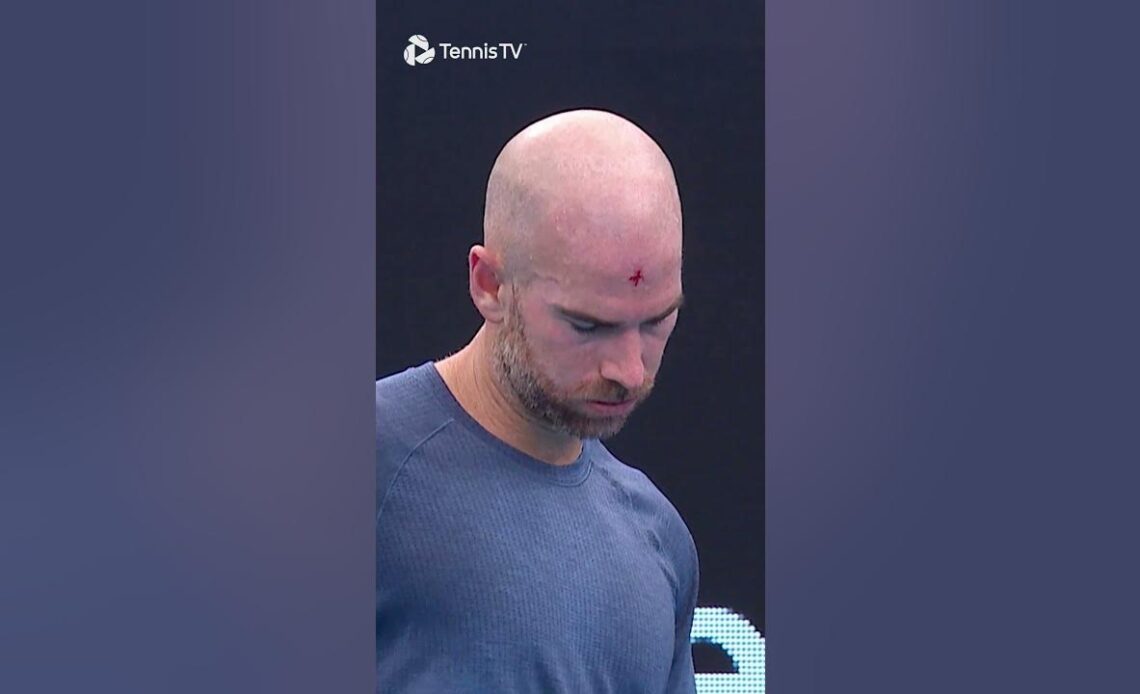 Mannarino Hits Himself In The FACE With His Racket 🤕